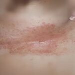 Buy Sanitary Pads Online | Premium Female Sanitary Napkins & Women Napkin